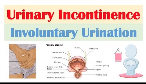 Involuntary Urination